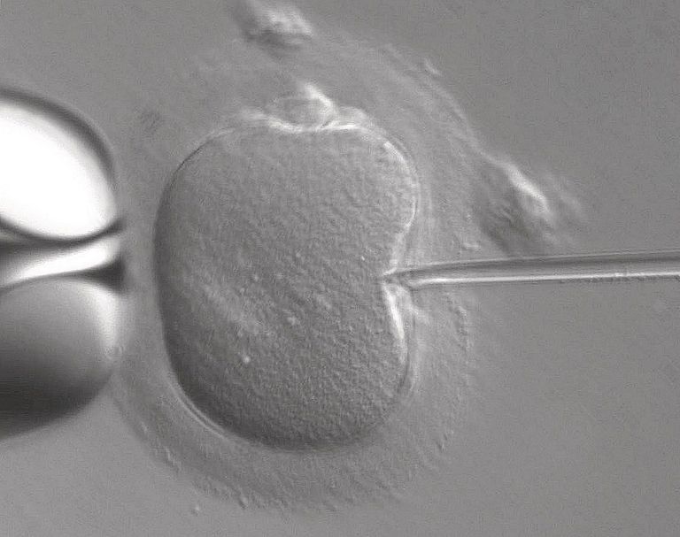IVF Capillary Tube Insertion IVF Capillary Tube Insertion