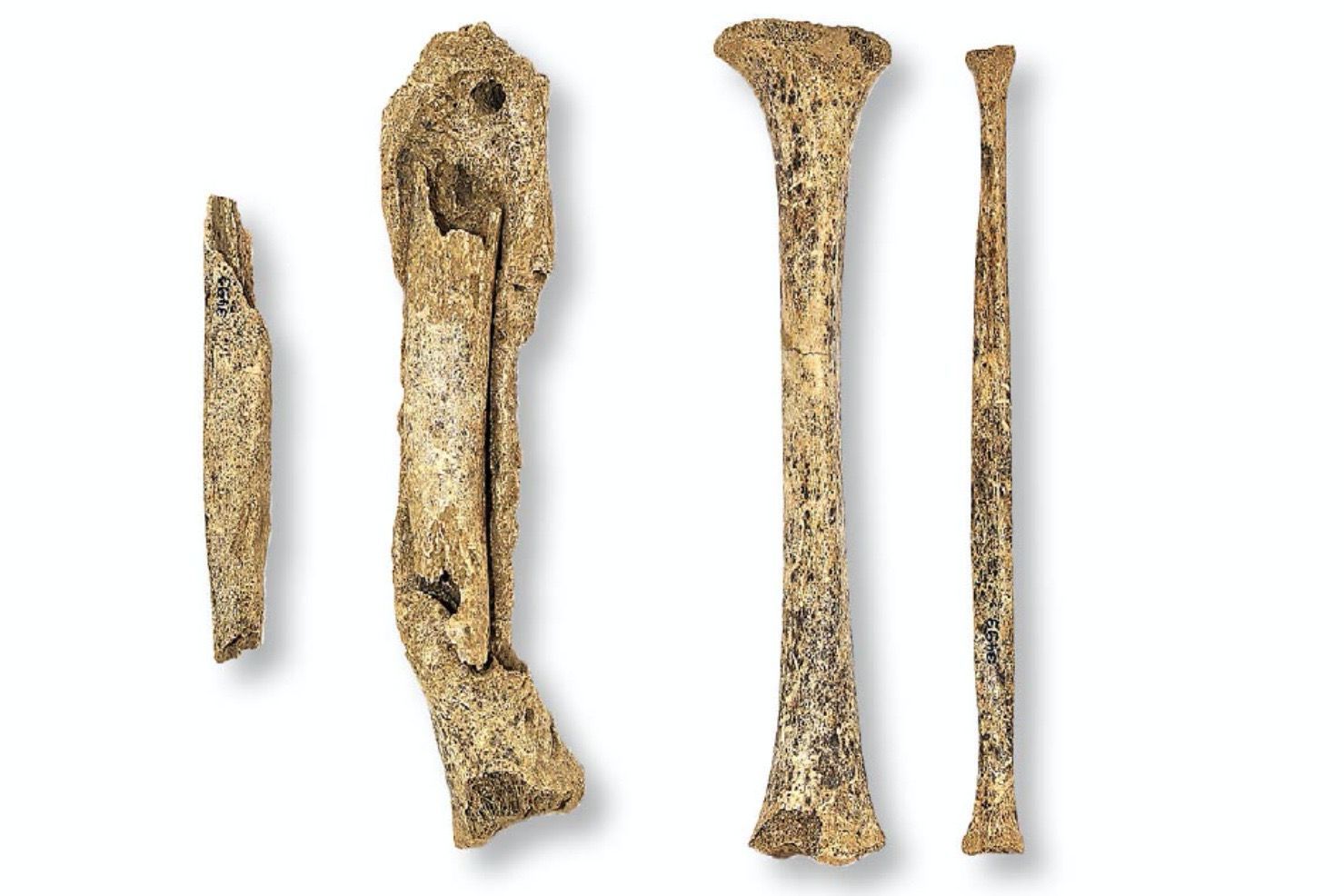 Fotografie von/Photographie de: Uniklinik Balgrist, Zürich, Carol Urfer (Ins, Kirchgemeindehaus 1987, Grab8). Rechte und linke Tibia und Fibula frontal (positioniert in der in situ-Lage). Fotografie von/Photographie de: Uniklinik Balgrist, Zürich, Carol Urfer (Ins, Kirchgemeindehaus 1987, Grab8). Rechte und linke Tibia und Fibula frontal (positioniert in der in situ-Lage).