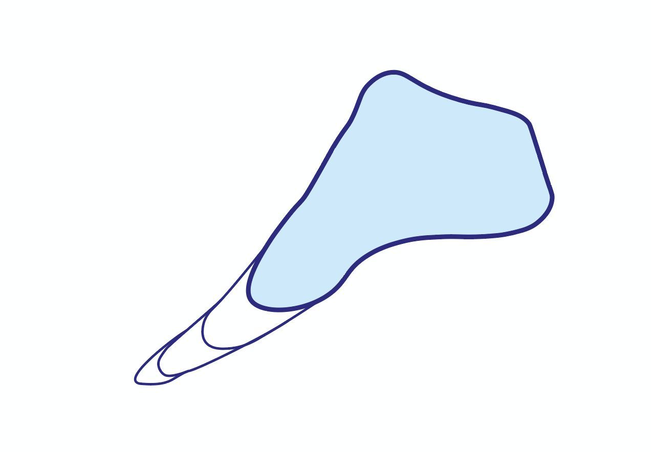 Längenänderung Längenänderung