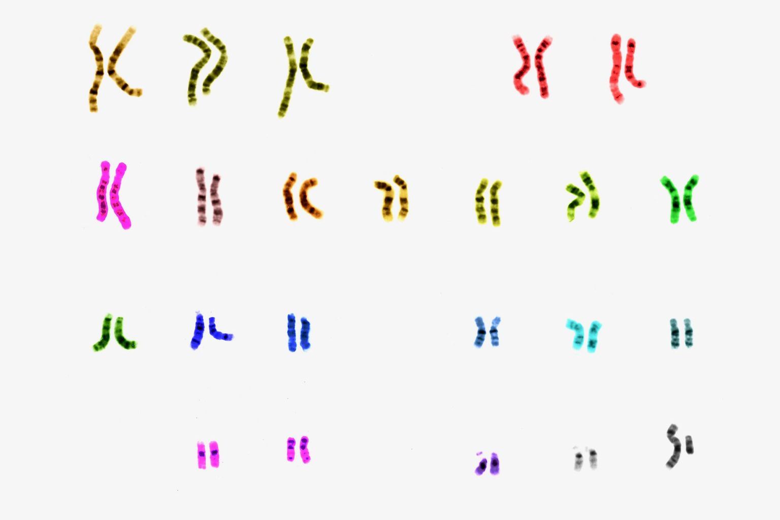 Chromosomes Chromosomes